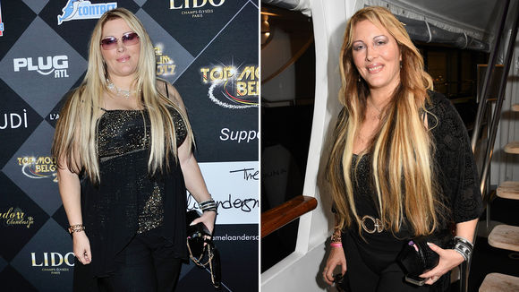 « J'ai subi une inter­ven­tion chirur­gi­cale »